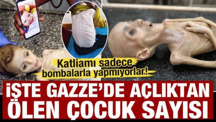 Gazze’de açlıktan ölen çocuk sayısı arttı! En küçüğü 14 günlük