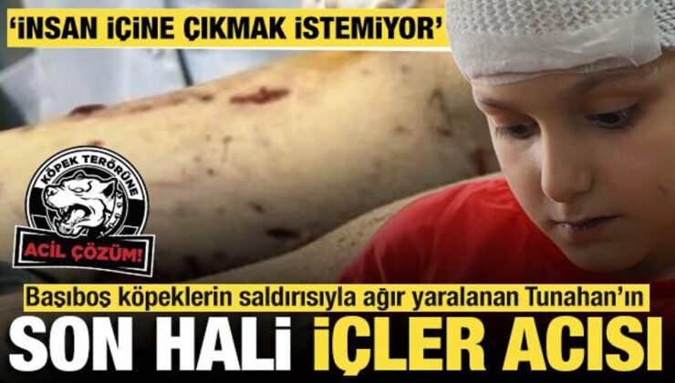 Başıboş köpeklerin saldırısıyla ağır yaralanan Tunahan’ın son hali içler acısı