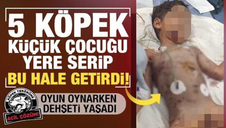 Başıboş köpekler dehşet saçtı! 5 yaşındaki çocuk ağır yaralandı